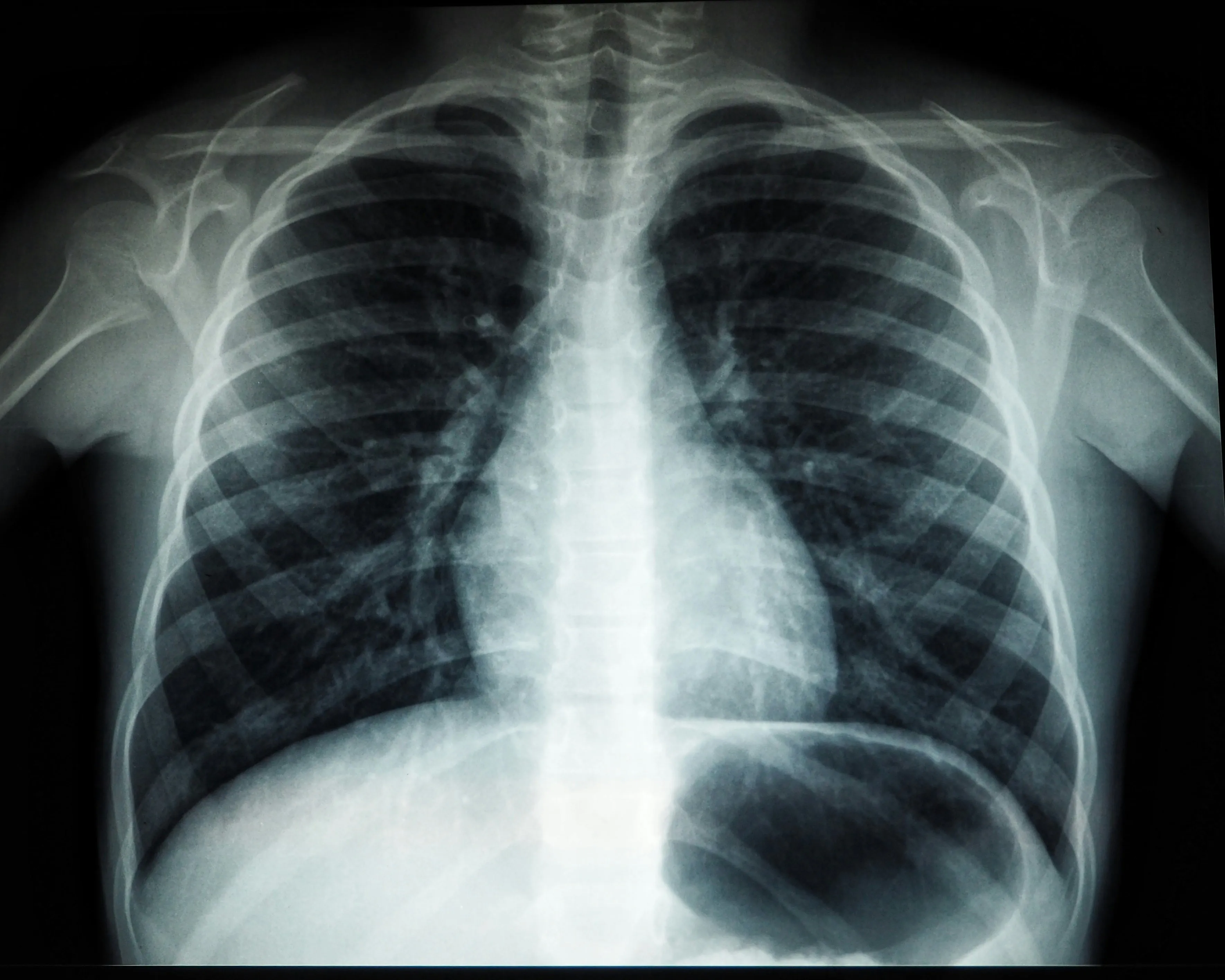 Chest X-ray review